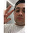 theusmolina